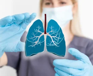 Start a Respiratory PCD Pharma Franchise